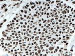 KAP1 Antibody in Immunohistochemistry (Paraffin) (IHC (P))