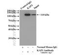 KAP1 Antibody in Immunoprecipitation (IP)