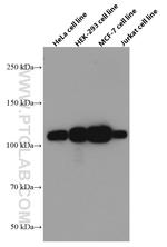 KAP1 Antibody in Western Blot (WB)