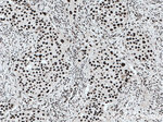 KAP1 Antibody in Immunohistochemistry (Paraffin) (IHC (P))