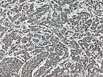 KAP1 Antibody in Immunohistochemistry (Paraffin) (IHC (P))