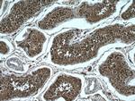 NEK2 Antibody in Immunohistochemistry (Paraffin) (IHC (P))