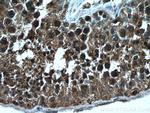 NEK2 Antibody in Immunohistochemistry (Paraffin) (IHC (P))