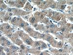 ROCK2 Antibody in Immunohistochemistry (Paraffin) (IHC (P))