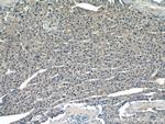 ROCK2 Antibody in Immunohistochemistry (Paraffin) (IHC (P))