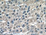 ROCK2 Antibody in Immunohistochemistry (Paraffin) (IHC (P))