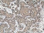 FIS1 Antibody in Immunohistochemistry (Paraffin) (IHC (P))