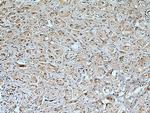 TGFBR2 Antibody in Immunohistochemistry (Paraffin) (IHC (P))