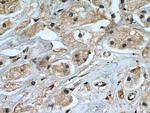 TGFBR2 Antibody in Immunohistochemistry (Paraffin) (IHC (P))