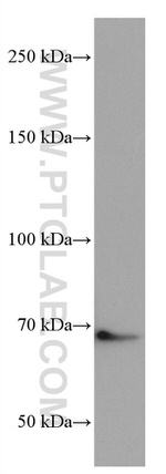 TGFBR2 Antibody in Western Blot (WB)