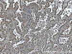 p70(S6K) Antibody in Immunohistochemistry (Paraffin) (IHC (P))