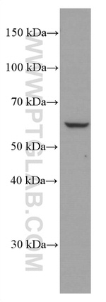 p70(S6K) Antibody in Western Blot (WB)