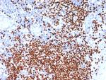 SOX11 (Mantle Cell Lymphoma Marker) Antibody in Immunohistochemistry (Paraffin) (IHC (P))