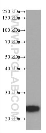 ANGPTL8 Antibody in Western Blot (WB)