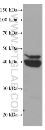 CEBPB Antibody in Western Blot (WB)