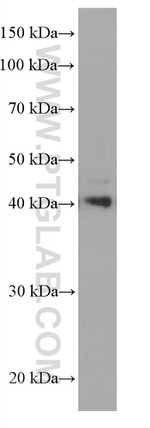 CEBPB Antibody in Western Blot (WB)