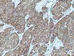 IRAK1 Antibody in Immunohistochemistry (Paraffin) (IHC (P))