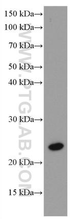 RAB43 Antibody in Western Blot (WB)