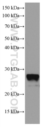 RAB43 Antibody in Western Blot (WB)