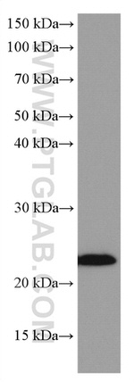 RAB43 Antibody in Western Blot (WB)