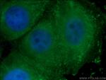 WNT2 Antibody in Immunocytochemistry (ICC/IF)