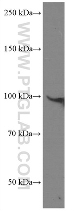 DDX54 Antibody in Western Blot (WB)