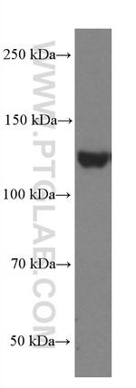 EPHA7 Antibody in Western Blot (WB)