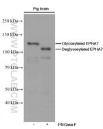 EPHA7 Antibody in Western Blot (WB)