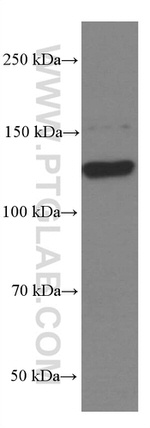 EPHA7 Antibody in Western Blot (WB)