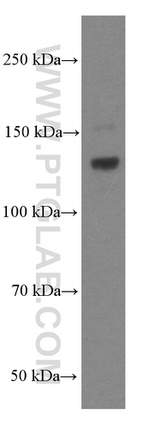 EPHA7 Antibody in Western Blot (WB)