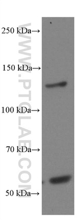 EPHA7 Antibody in Western Blot (WB)