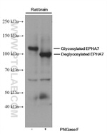 EPHA7 Antibody in Western Blot (WB)