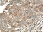 PLCB3 Antibody in Immunohistochemistry (Paraffin) (IHC (P))