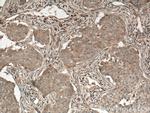 PLCB3 Antibody in Immunohistochemistry (Paraffin) (IHC (P))