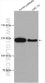 PLCB3 Antibody in Western Blot (WB)