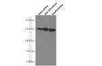 PLCB3 Antibody in Western Blot (WB)