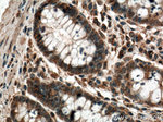 PLCB3 Antibody in Immunohistochemistry (Paraffin) (IHC (P))