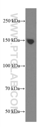 PLCB3 Antibody in Western Blot (WB)