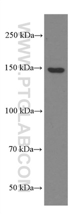 PLCB3 Antibody in Western Blot (WB)