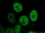 ASF/SF2 Antibody in Immunocytochemistry (ICC/IF)