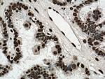 ASF/SF2 Antibody in Immunohistochemistry (Paraffin) (IHC (P))