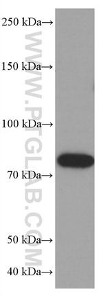 PLZF Antibody in Western Blot (WB)