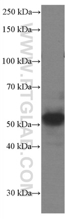 PARK2/Parkin Antibody in Western Blot (WB)