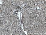 MLKL Antibody in Immunohistochemistry (Paraffin) (IHC (P))