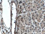 MLKL Antibody in Immunohistochemistry (Paraffin) (IHC (P))