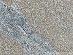 MLKL Antibody in Immunohistochemistry (Paraffin) (IHC (P))