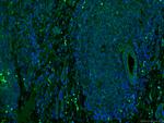 MLKL Antibody in Immunohistochemistry (PFA fixed) (IHC (PFA))