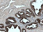 PSMA/GCPII Antibody in Immunohistochemistry (Paraffin) (IHC (P))