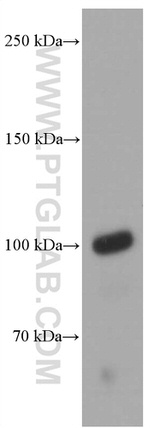 PSMA/GCPII Antibody in Western Blot (WB)