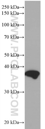 TMEM173/STING Antibody in Western Blot (WB)